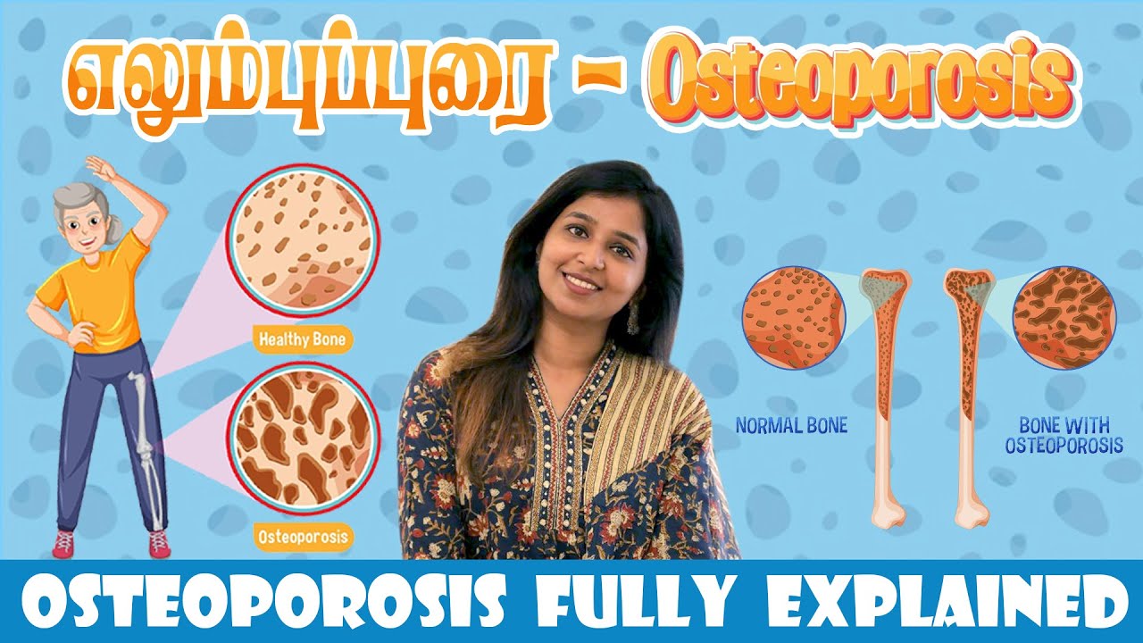 Osteoporosis  Explained by Dr.Sharmika | #daisyhospital #osteoporosis #cure #tips #bodypainrelief