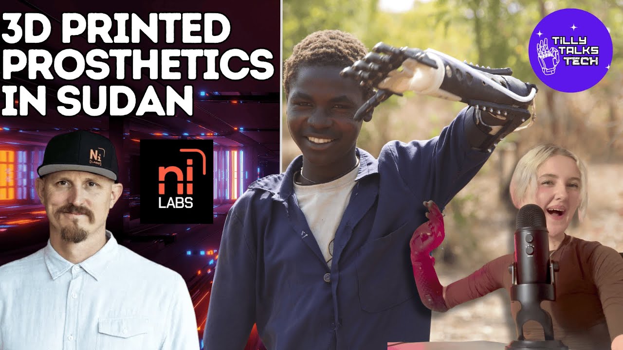 Tech That Changes Lives: Mick Ebeling from Not Impossible Labs on Tilly Talks Tech!