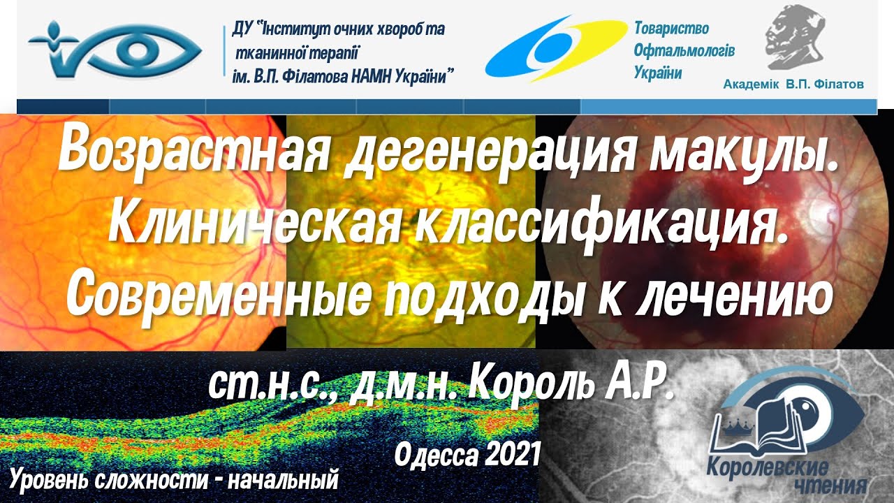 Возрастная дегенерация макулы. Клиническая классификация. Современные подходы к лечению