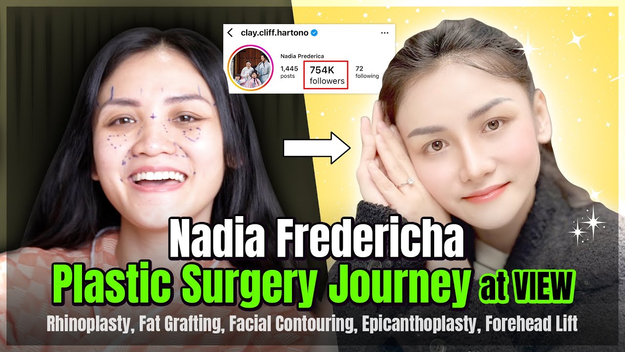 I got plastic surgery in Korea Part 2 #viewplasticsurgery