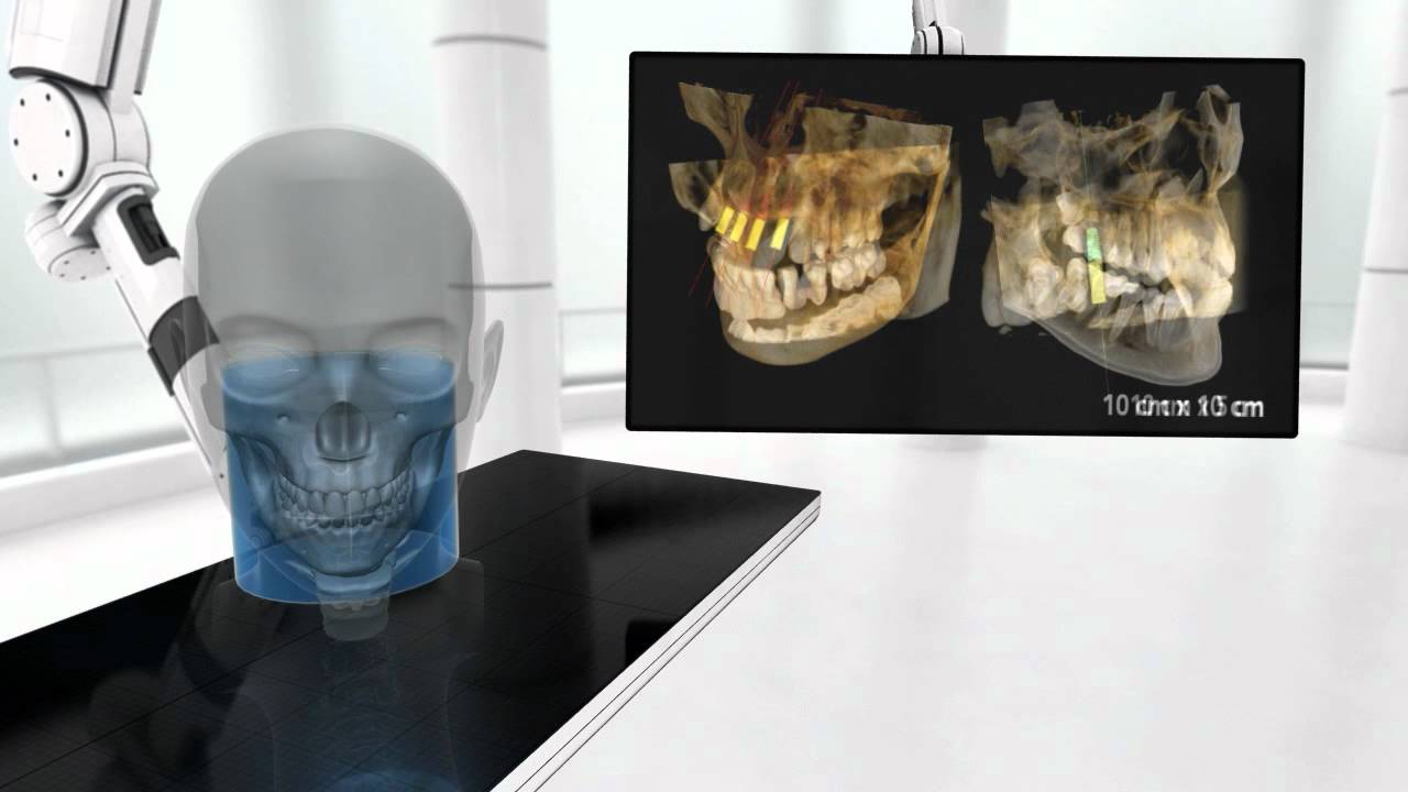 Tomografía Computada Cone Beam Carestream CS 9300 (Inglés)