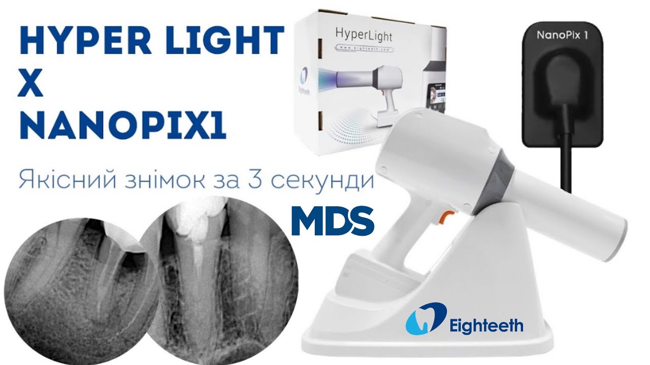 Рентген HyperLight і датчик NanoPix1 Eighteeth від MDS - комплект для миттєвих знімків