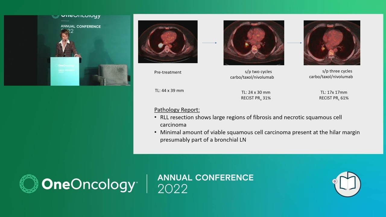 Local Lung Cancer | 2022 OneOncology Conference