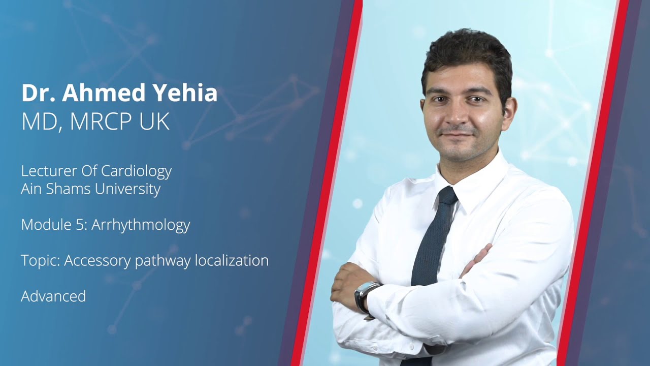 Accessory pathway localization - Dr. Ahmed Yehia