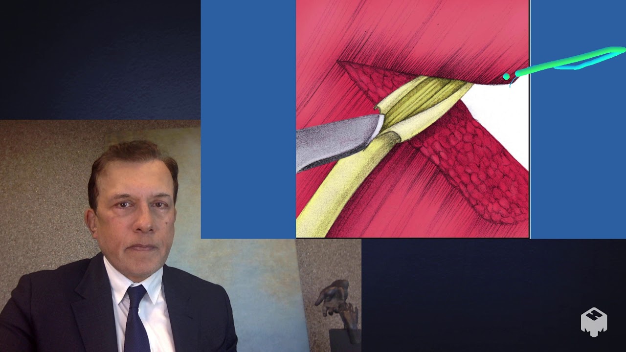 Dr. Nath explains Neurolysis (Scar removal) for Winging Scapula & Long Thoracic injury