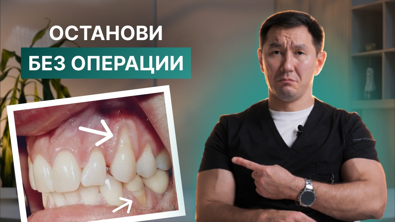 Появились корни зубов? Сделай это дома, БЕЗ ОПЕРАЦИИ, чтобы зубы не выпали