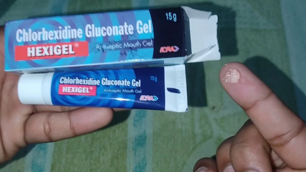Hexigel Antiseptic Mouth Gel Review