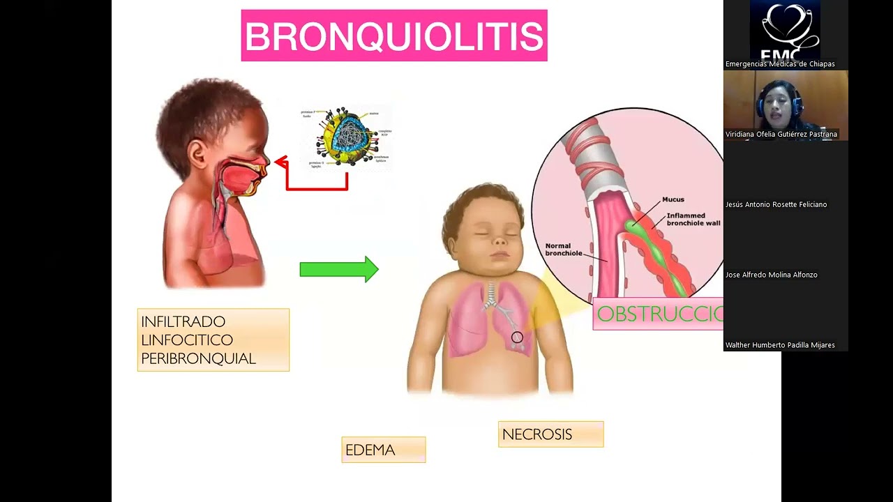 INFECCIONES RESPIRATORIAS EN PEDIATRÍA