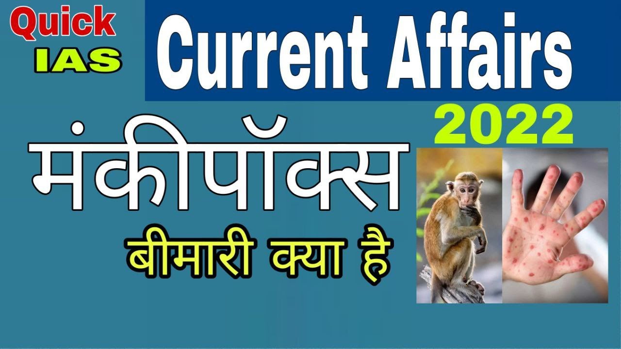 monkeypox virus (मंकीपॉक्स वायरस ) part -7