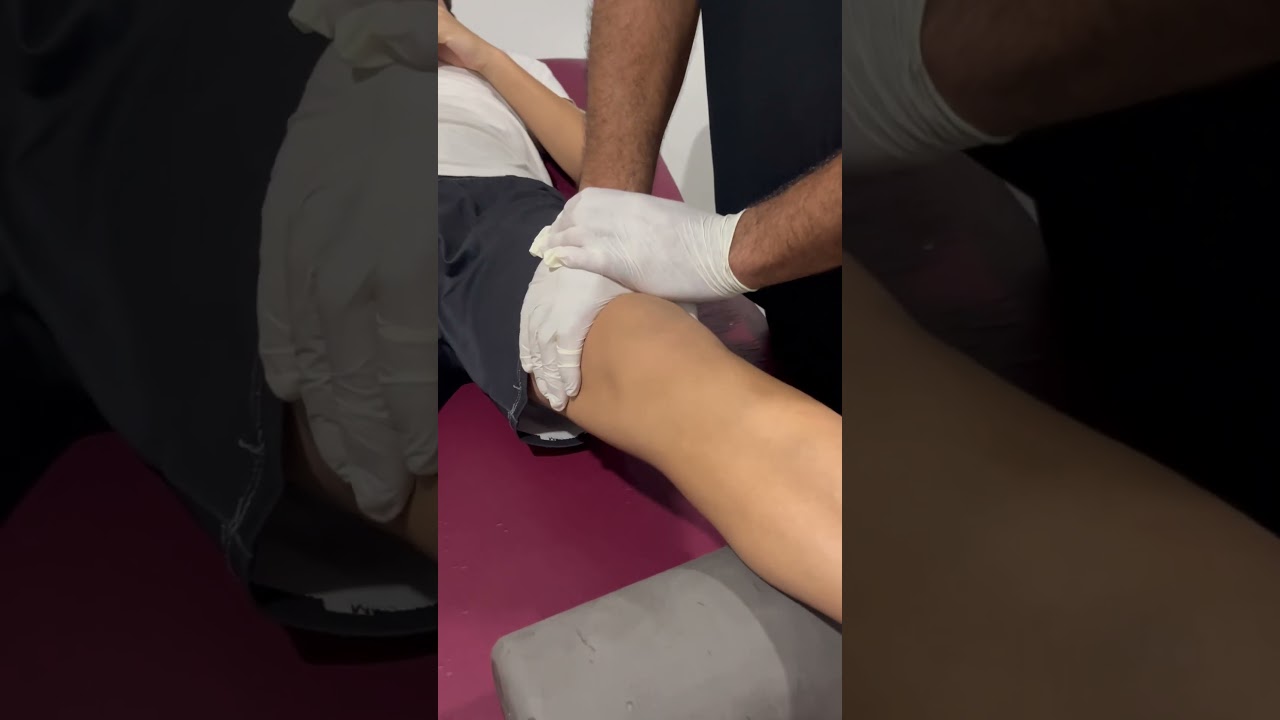 Lelli testi, ACL yırtığını değerlendirmek i&ccedil;in kullanılır.