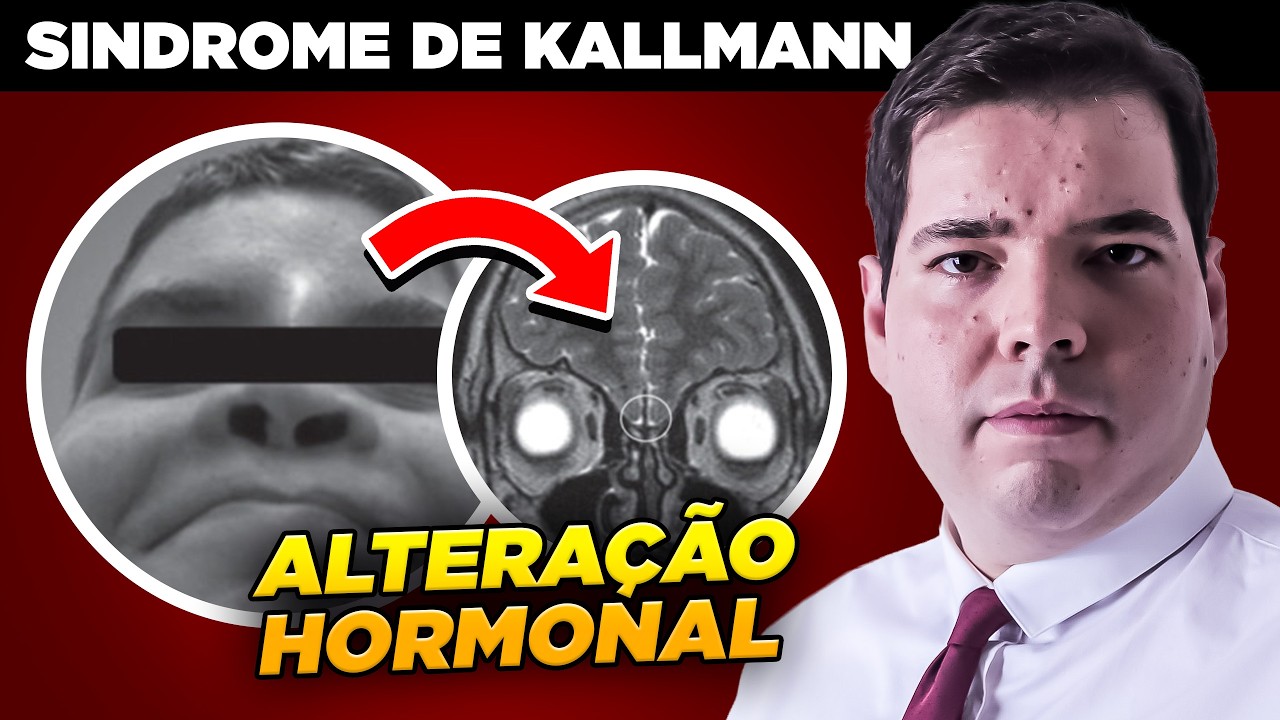Síndrome de Kallmann: O Que é e Quais São os Sinais