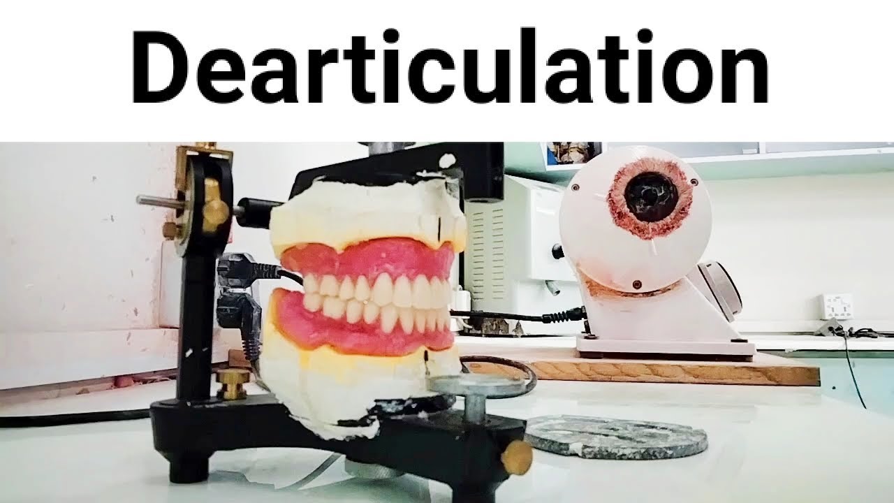 Step #10 Dearticulation #conplete_denture