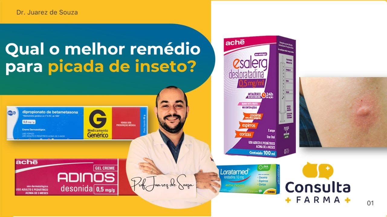 PICADA DE INSETO | Qual o melhor tratamento?