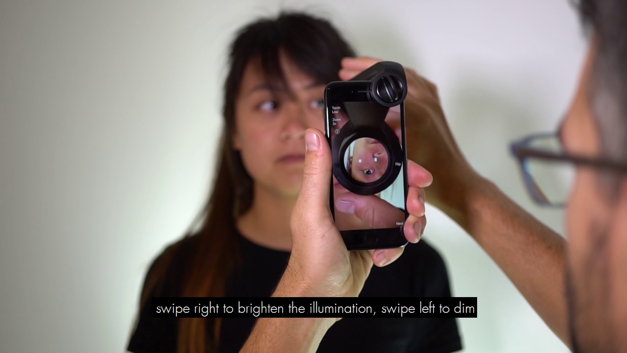 visoScope Smartphone Ophthalmoscope User Instruction