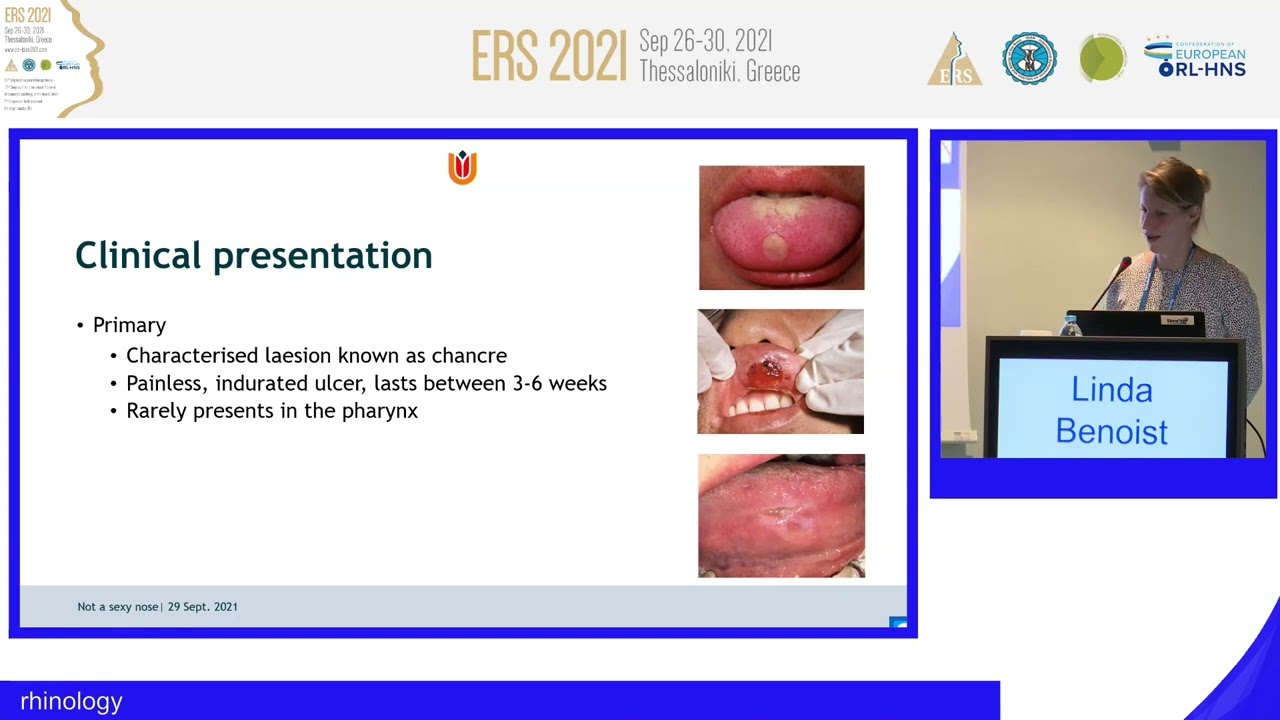 ERS Thessaloniki 2021,Sex, drugs and rock and roll &ndash; syphilis, cocaine and, Linda Benoist