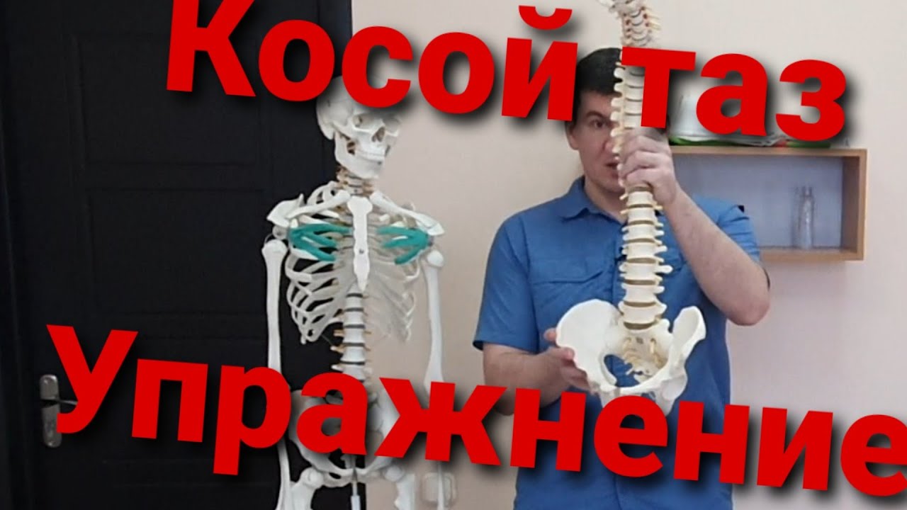 Упражнение для исправления перекоса таза. Как исправить с помощью ходьбы.
