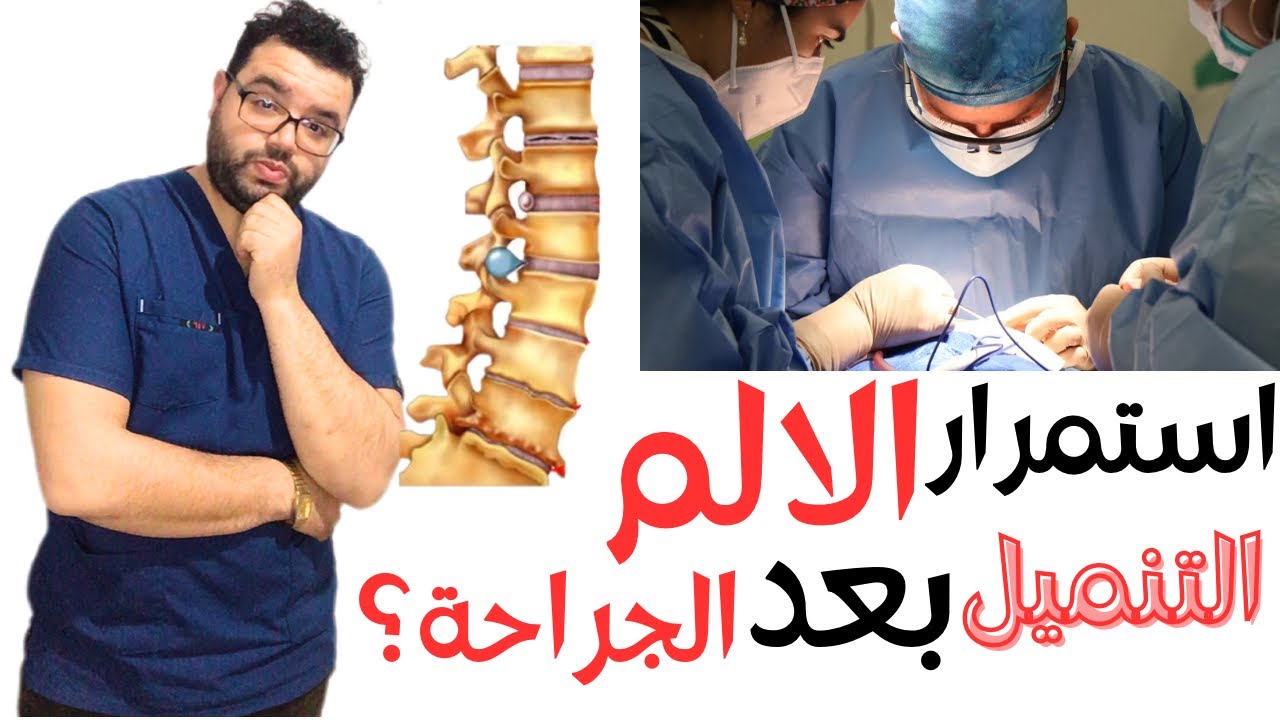 التنميل بعد عملية غضروف الظهر