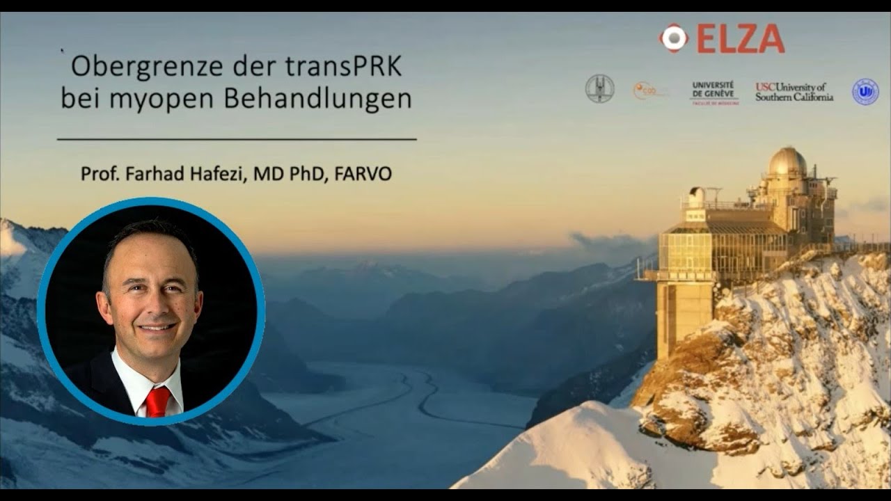 Obergrenze der TransPRK bei myopen Behandlungen? Prof. Farhad Hafezi, Schweiz (Webinar von SCHWIND)