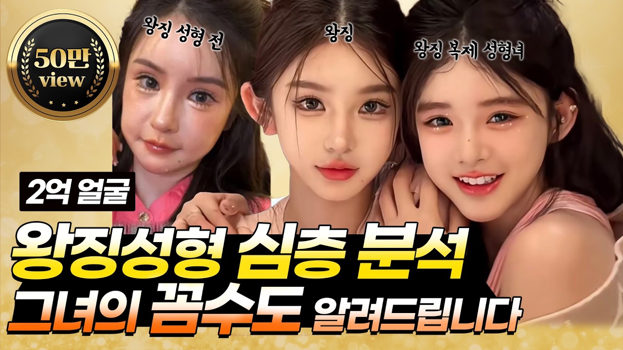 왕징성형 심층 분석! 그녀의 꼼수도 알려드릴게요 #왕징 #왕징성형 #중국성형 #필러부작용