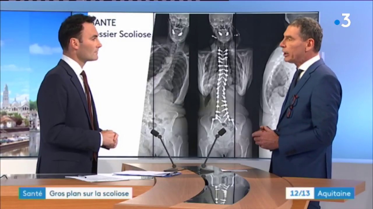 CHU de Bordeaux : centre de référence pour la chirurgie du dos