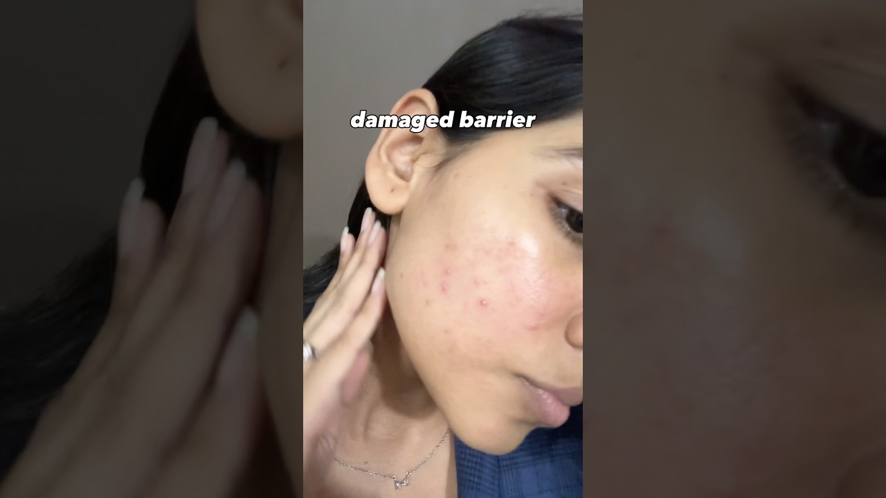 VIT C CAUSING MORE DAMAGE ‼️check description 