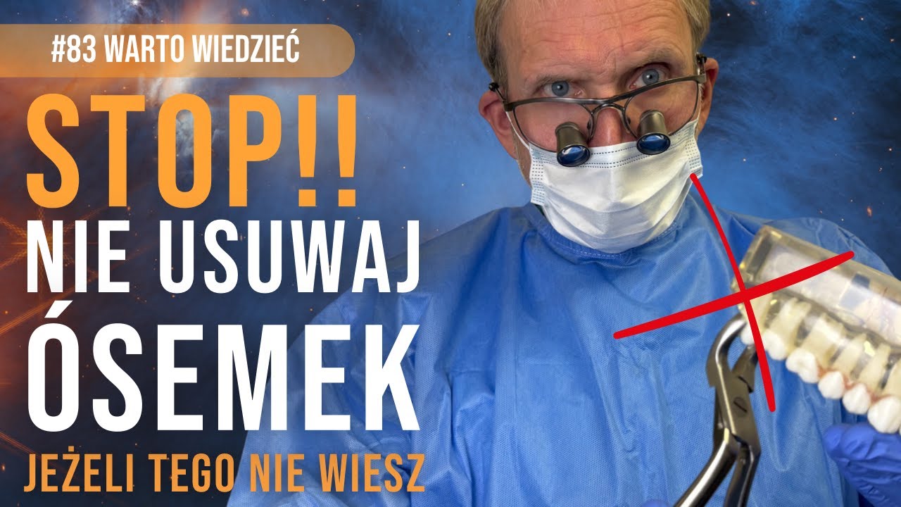 Usuwanie ósemek...  to jeden z najbardziej stresujących tematów w stomatologii. Warto wiedzieć #83