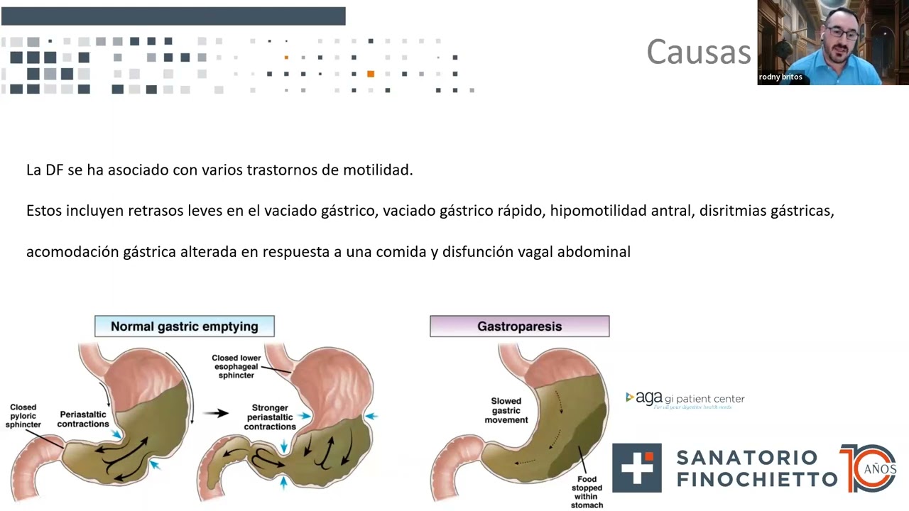 Clase 9 – Dispepsia funcional, nuevos avances diagnósticos. Dr. Rodny Britos