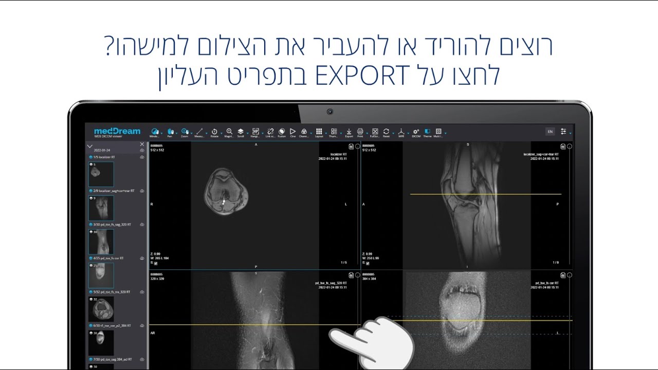 חדש באסותא: צילומי בדיקות הדימות באיזור האישי שלכם