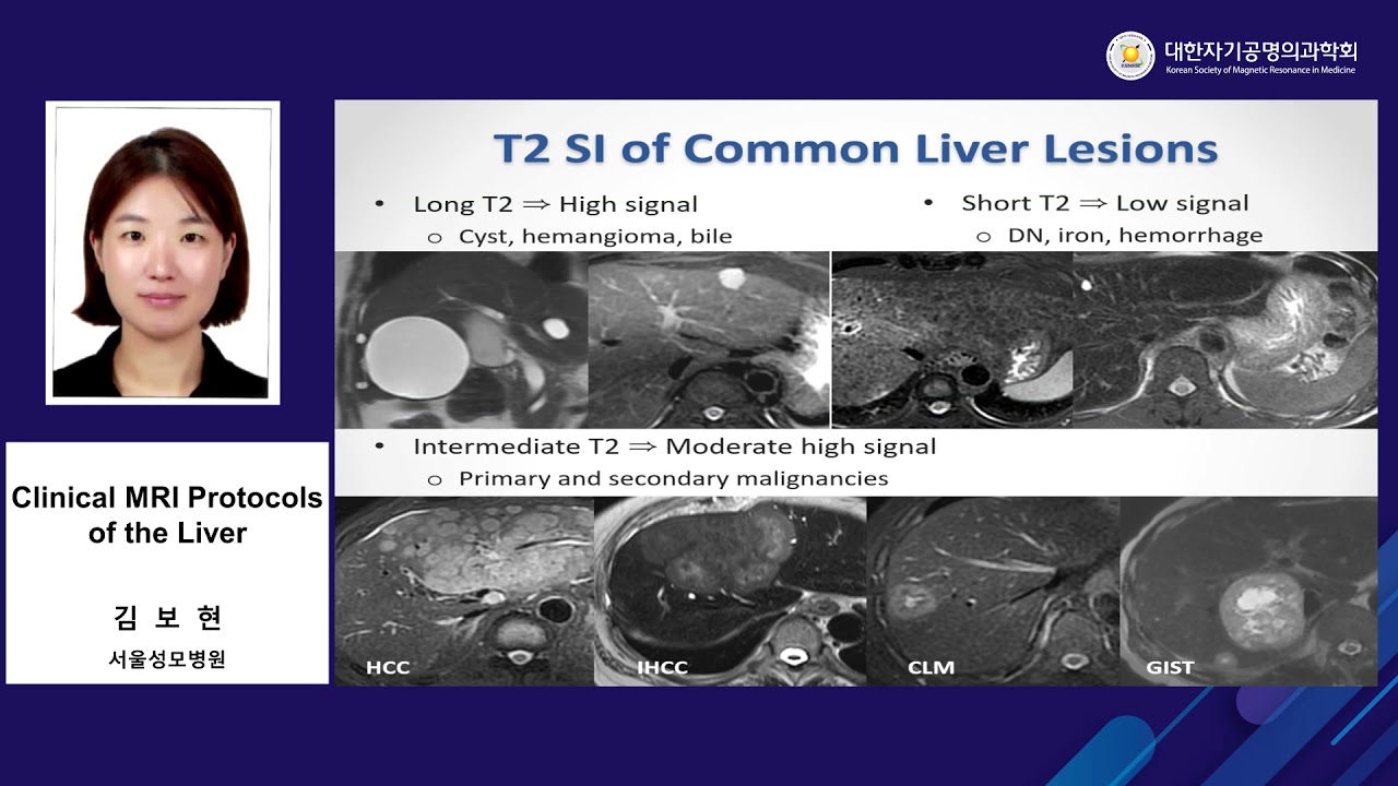 Lecture 07. (복부) Clinical MRI Protocols of the Liver
