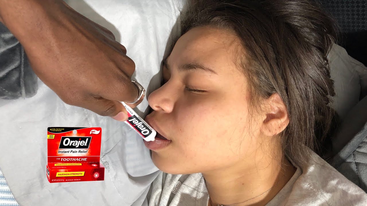 ORAJEL NUMBING MOUTH PRANK ON GIRLFRIEND!!! (Must Watch)