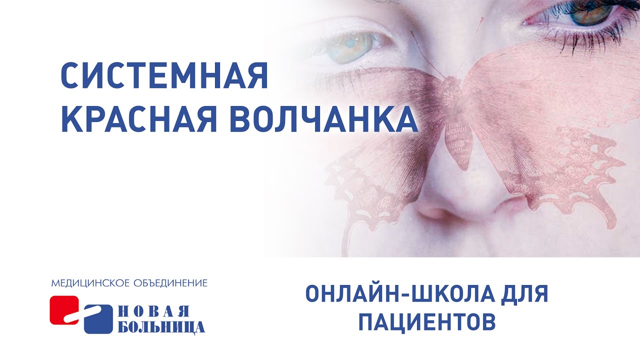 Системная красная волчанка