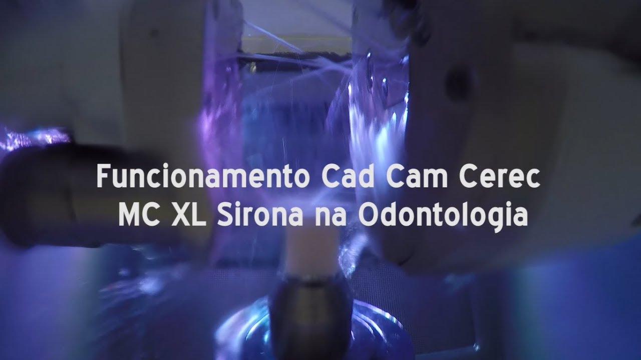 Funcionamento Cad/Cam Cerec Sirona na Odontologia: Conceito Side Chair