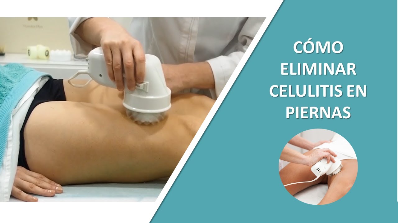 Cómo eliminar la celulitis de las piernas, ¡INFALIBLE!