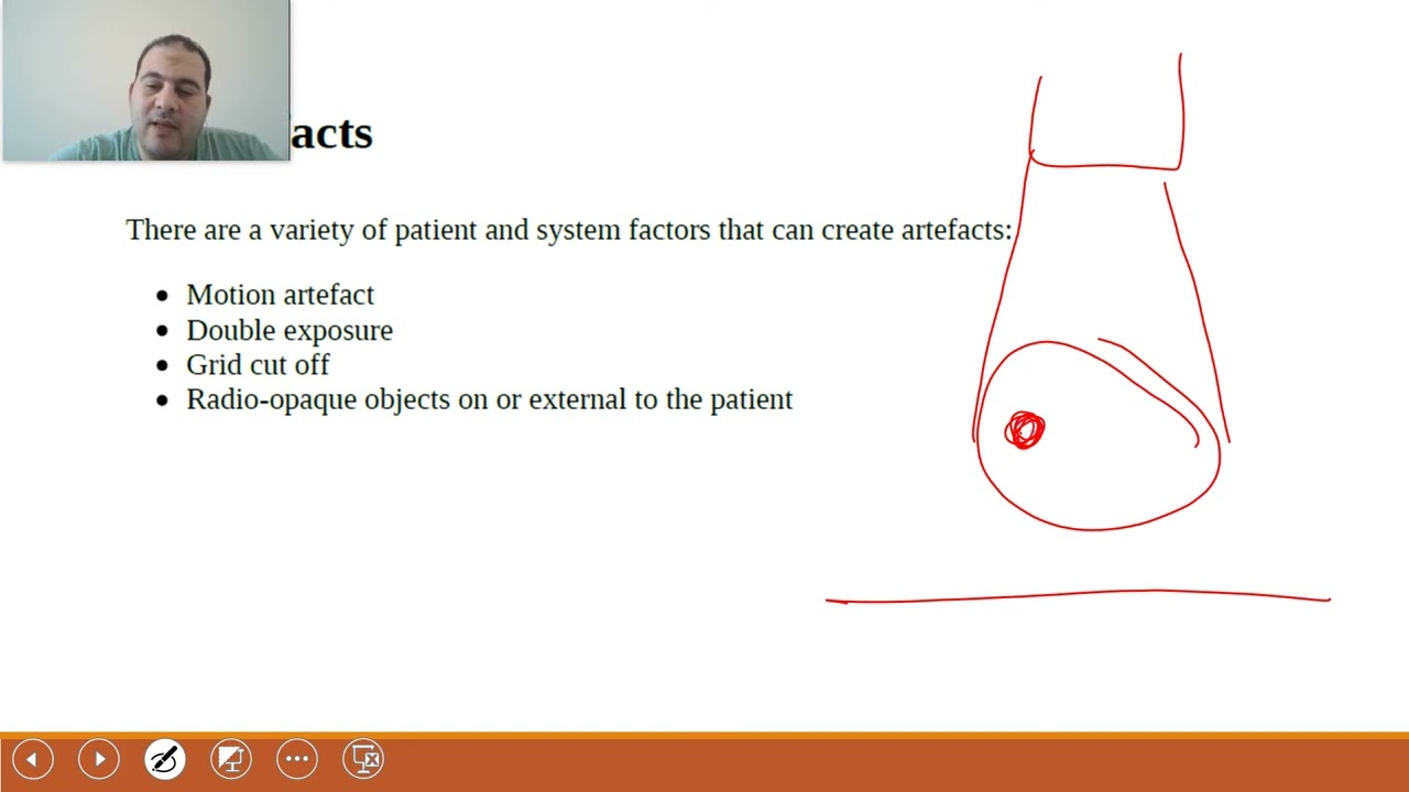 Lecture no 12 X Ray image artifacts