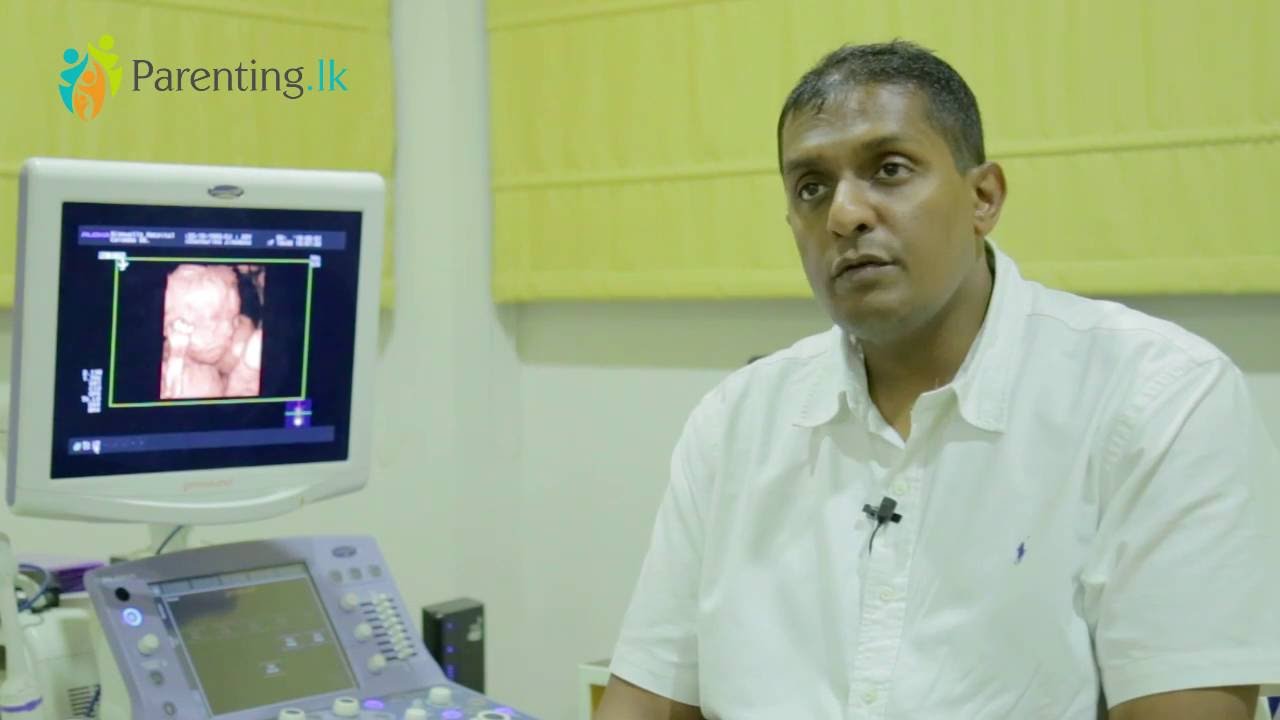 Prof. Tiran Dias - Anomalies Scan පරීක්ෂණය පිලිබඳ ඔබ දැනගත යුතුම කරුණු