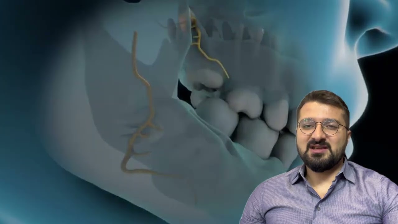 Ağıl dişinin çərrahi çəkimi prosedurunun ətraflı izahı - Uzm. Dr. Kamran Mammadov, PhD