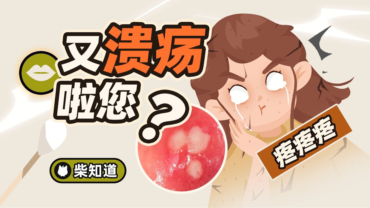又口腔溃疡啦您？有药吗，能治吗，除了挺着还有救吗？【柴知道】