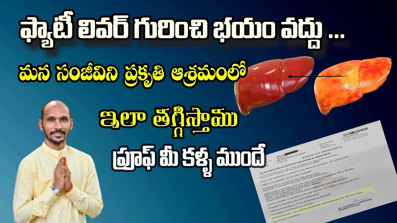 ఫ్యాటీ లివర్ గురించి భయం వద్దు, సంజీవిని ఆశ్రమంలో ఇలా తగ్గిస్తాము|FattyLiver|DrMadhuBabuHealthTrends