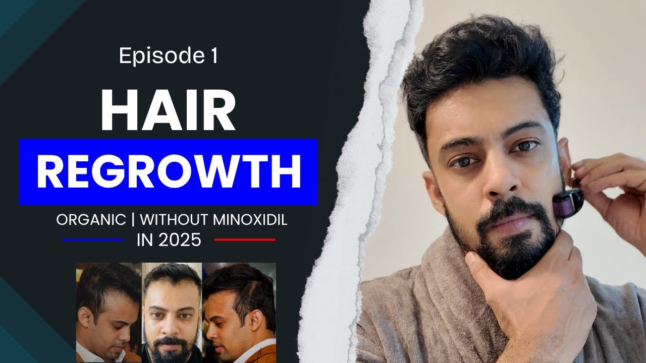 EPISODE 1 | REVERSE MALE PATTERN BALDNESS | MY HAIR GROWTH JOURNEY | DEVENDRA SINGH