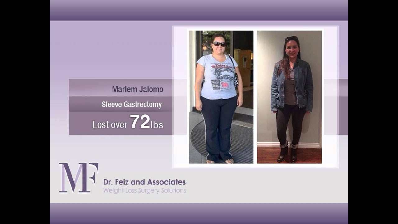 Dr. Feiz and Associates Patient Stories