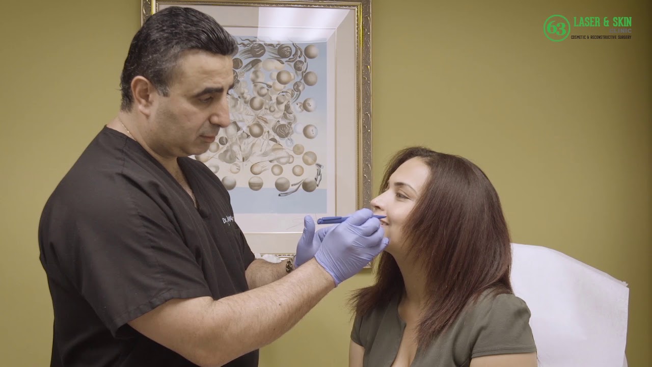 Angelica - Patient at 63 Skin Clinic