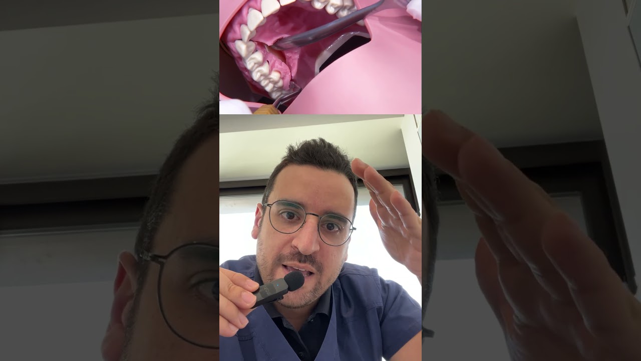 Chirurgie de la GENCIVE, le surfa&ccedil;age dentaire