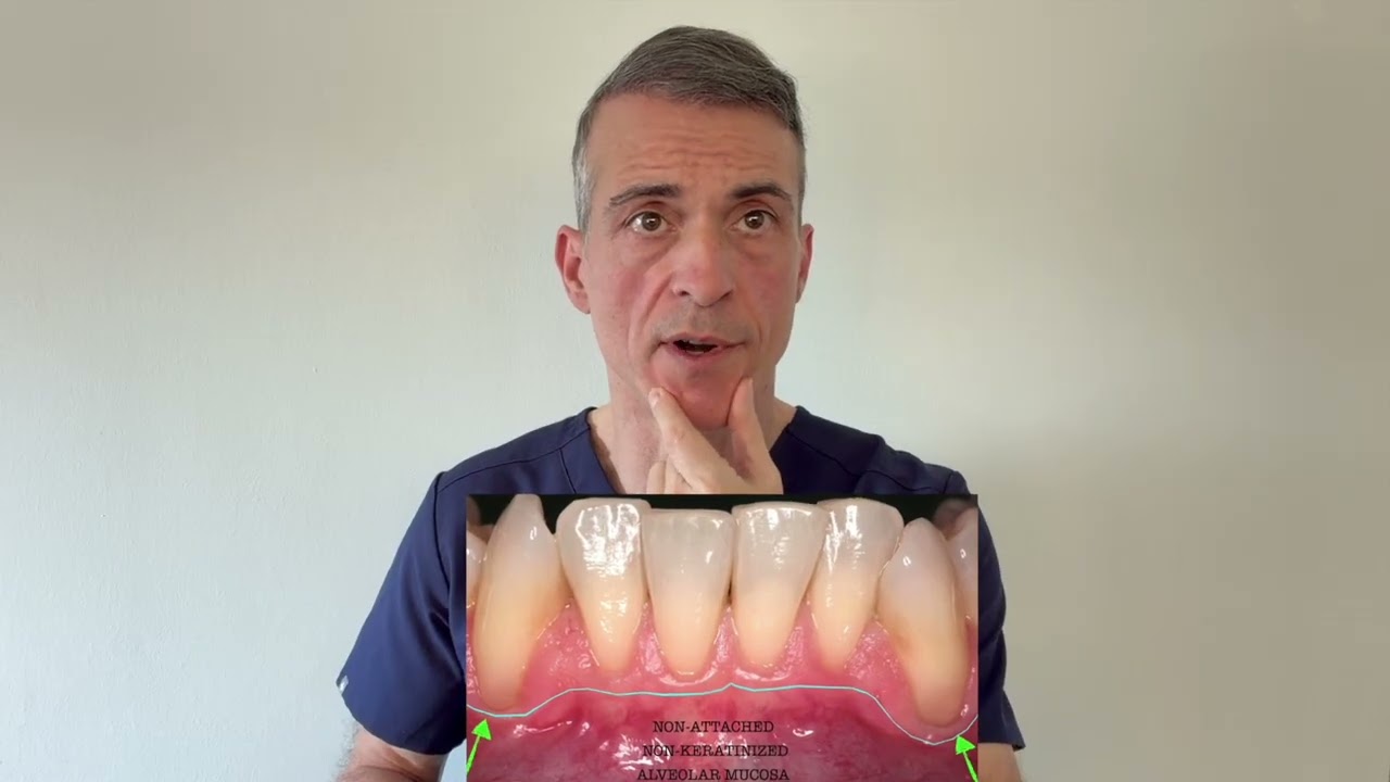 Receding GUMS: what works and what doesn't!