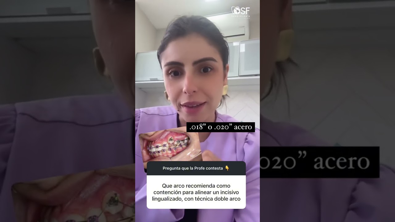 ¿por qué prefiero elegir el segundo arco con esta característica?