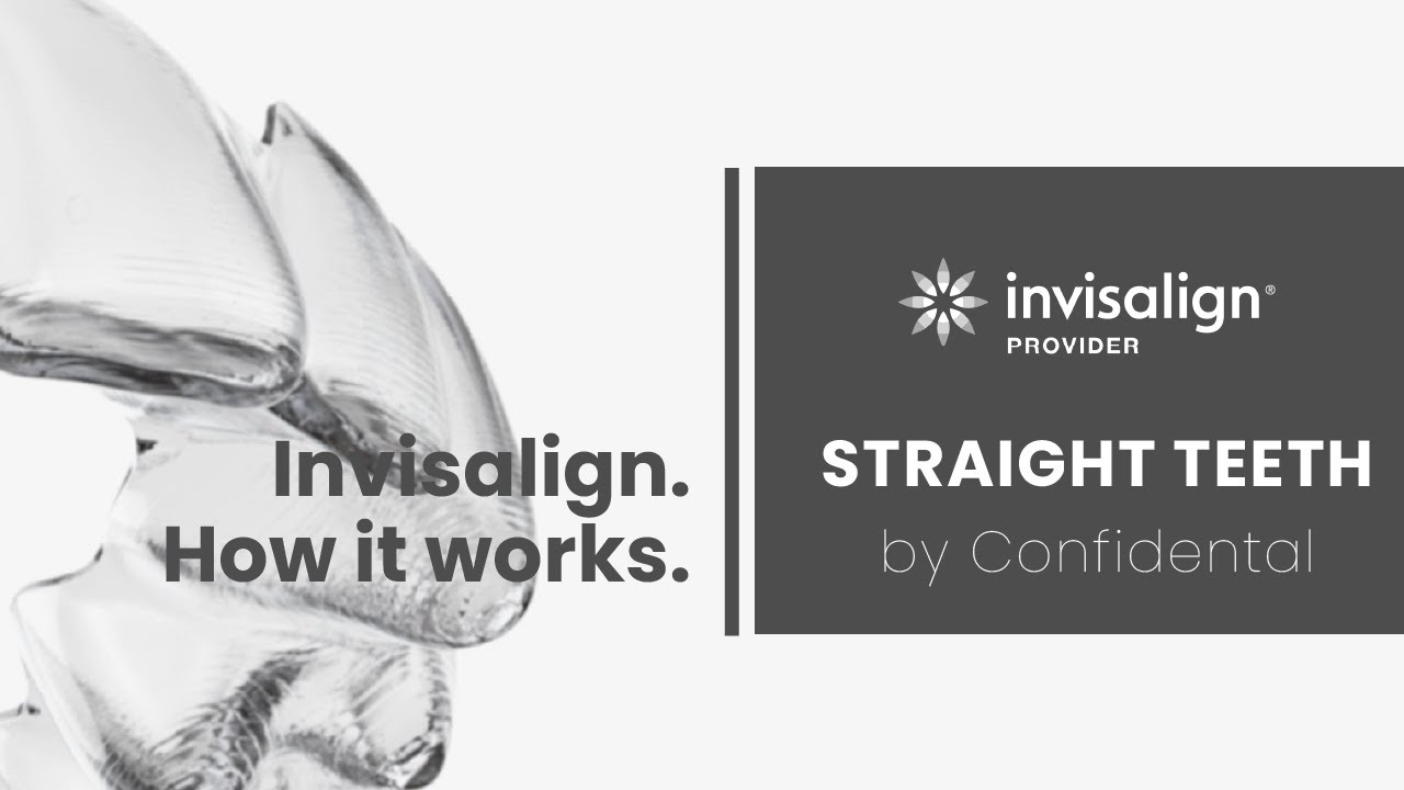 Invisalign How It Works