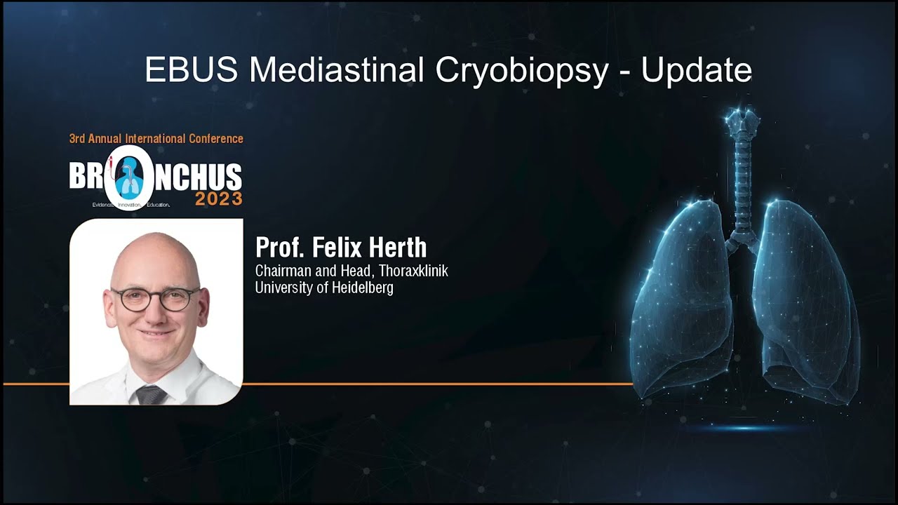 EBUS Mediastinal Cryobiopsy | Yashoda Hospitals Hyderabad