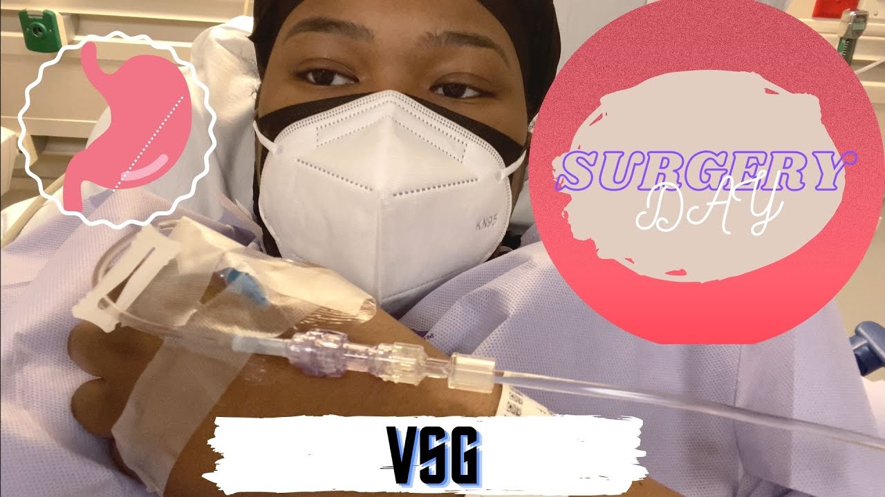 VSG SURGERY DAY