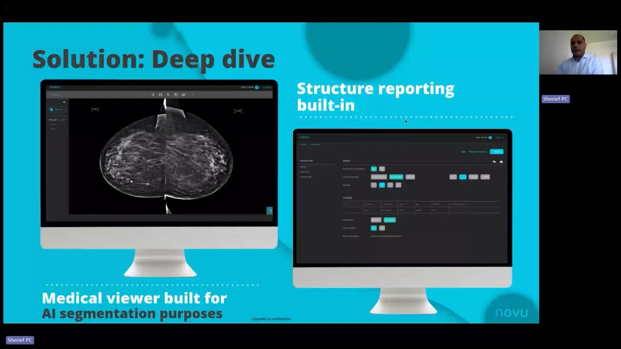 WEBINAR: MedDream Integration Case Study: NOVU AI