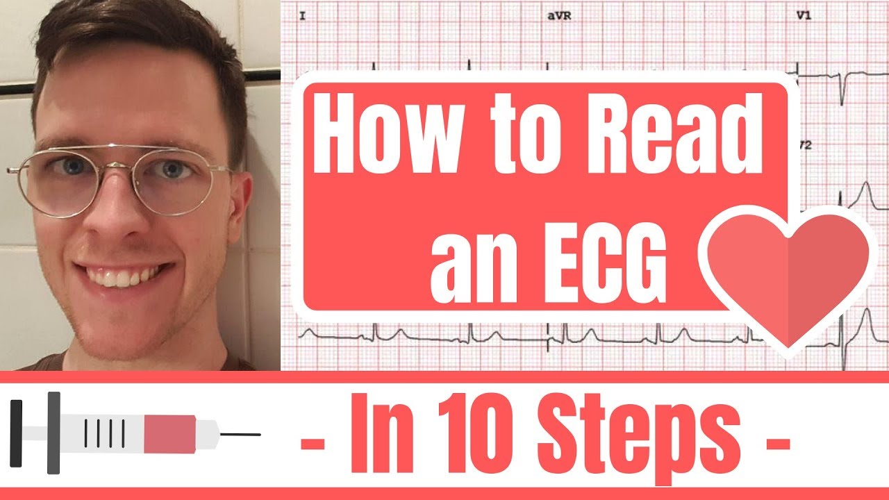 How to read an ECG! - in 10 steps -