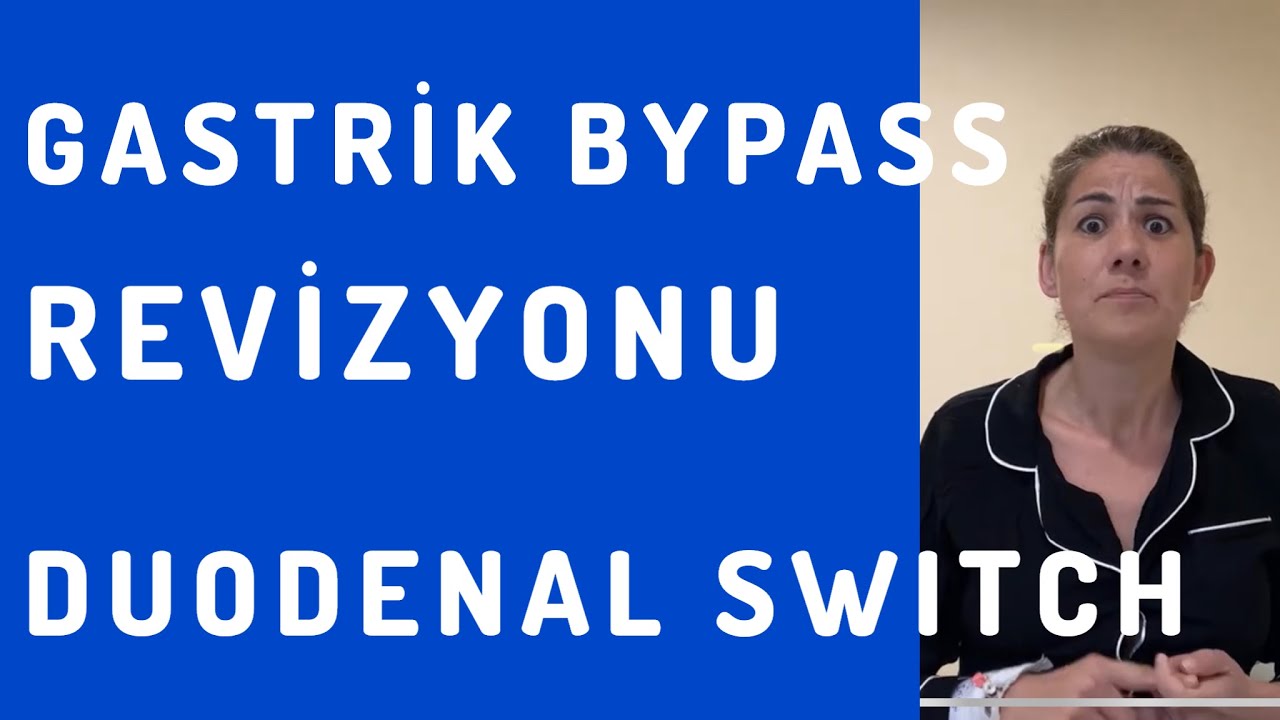 Gastrik Bypass Sonrası Hipoglisemik Dumping ve Kilo Alımı: Duodenal Switch’e Revizyonun Başarısı